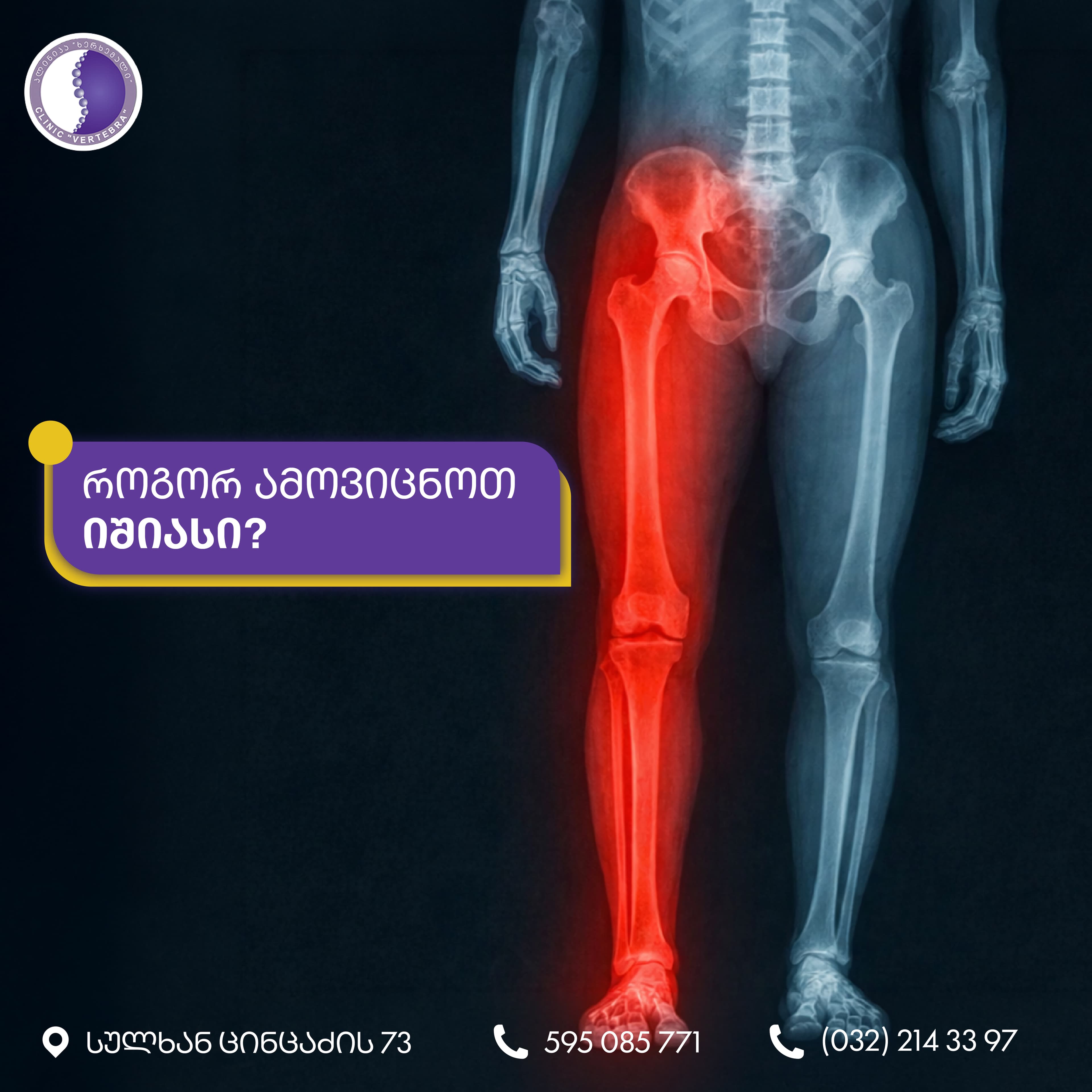 კლინიკა ხერხემალი - 2