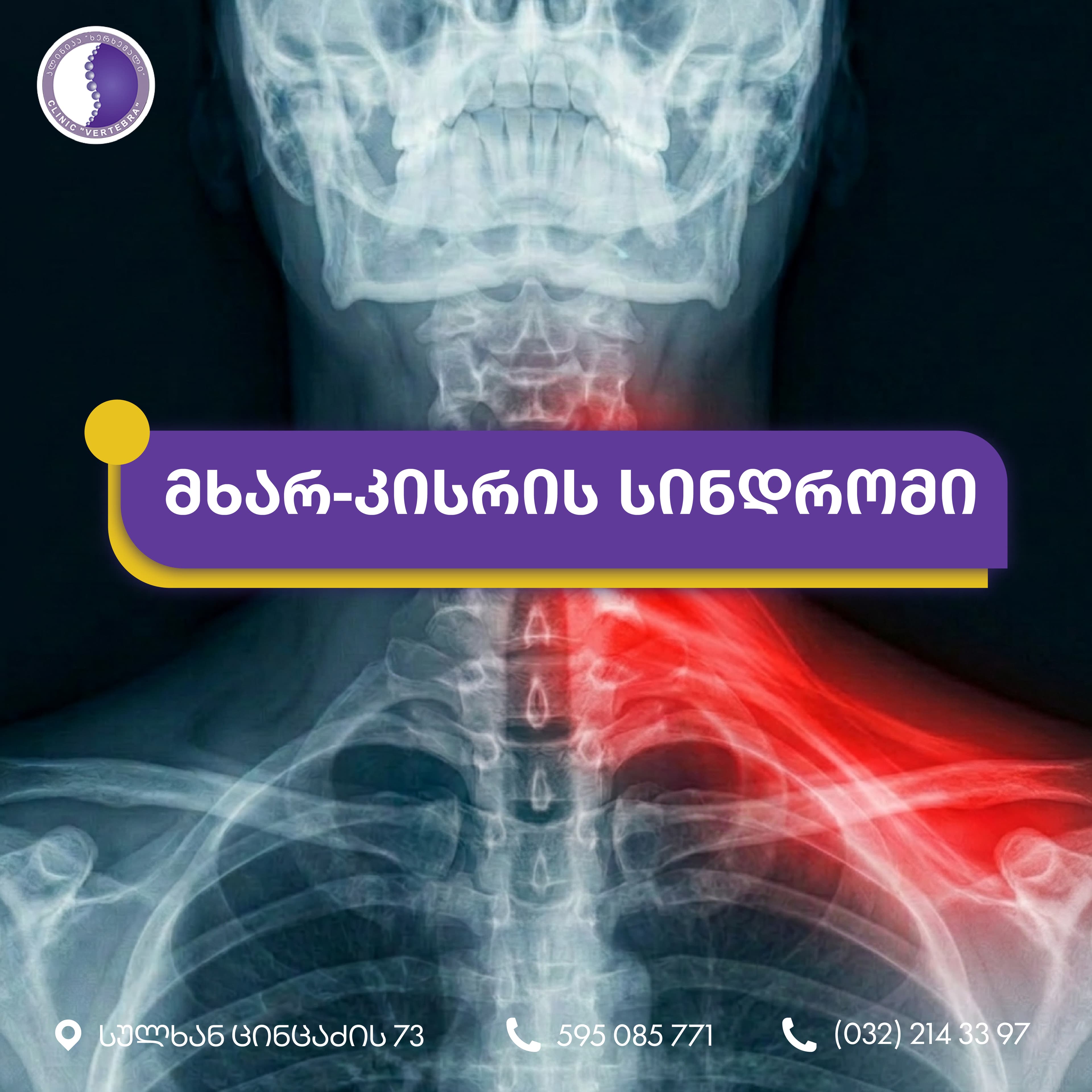 კლინიკა ხერხემალი - 7